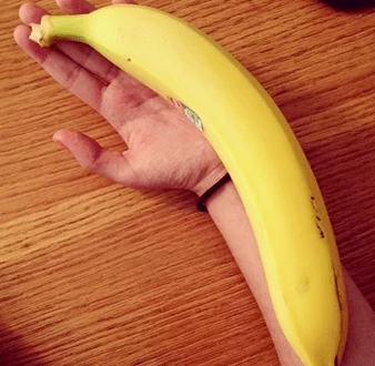 Penis Erweiderung